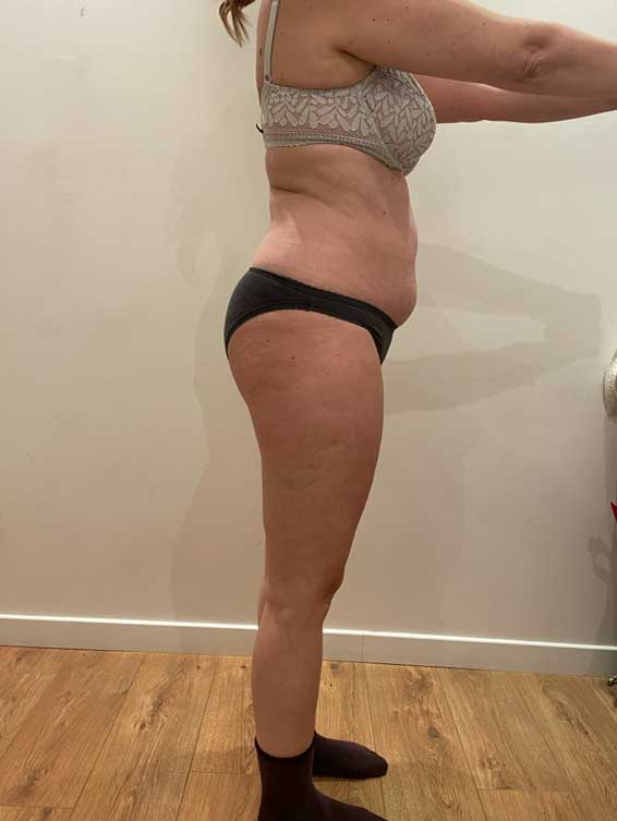 programme-minceur-paris-avant-après-2