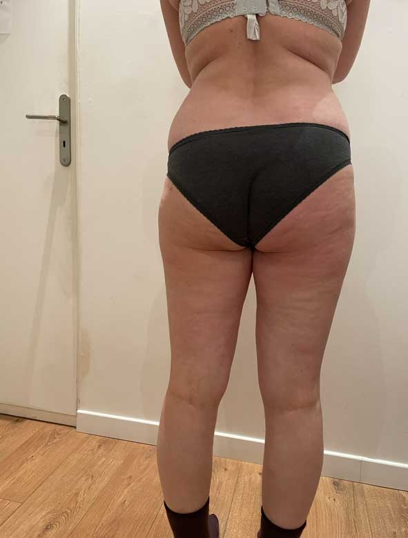 programme-minceur-paris-avant-après-3