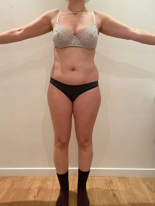 programme-minceur-paris-avant-après-4